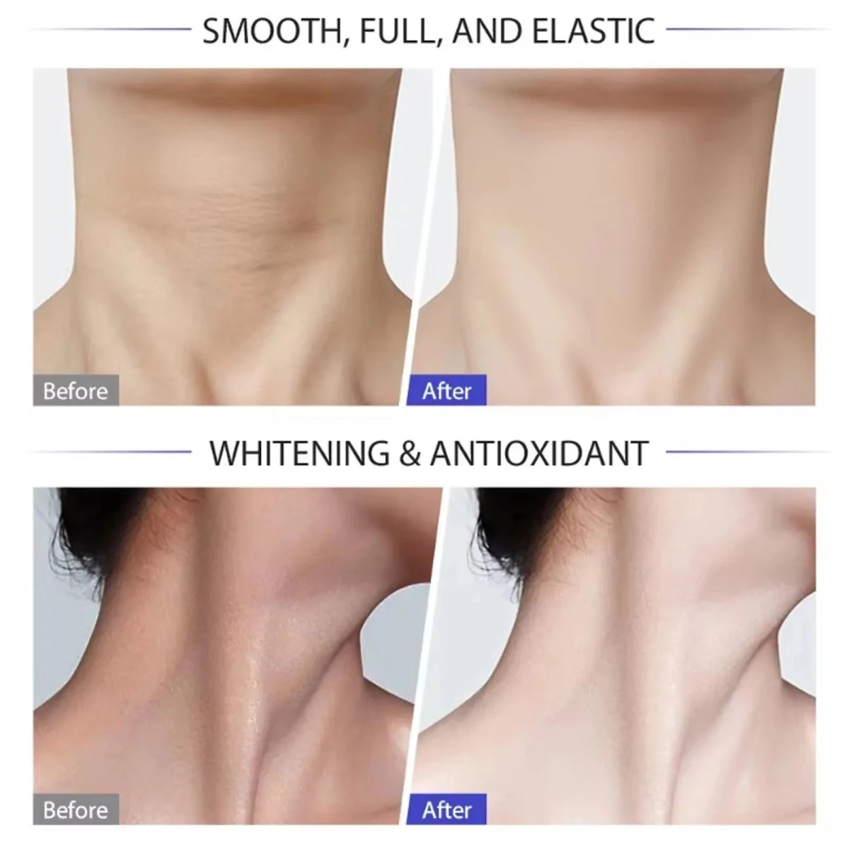 Vyral Neck Cream - Vyral