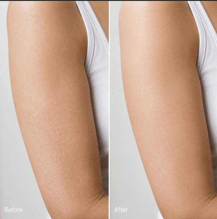 Vyral Arm Cream