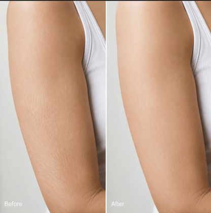 Vyral Arm Cream
