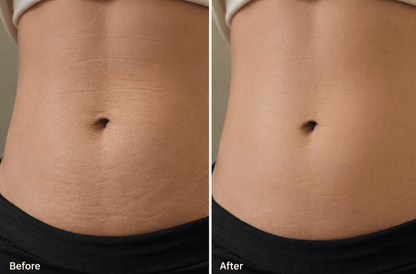Vyral Belly Cream